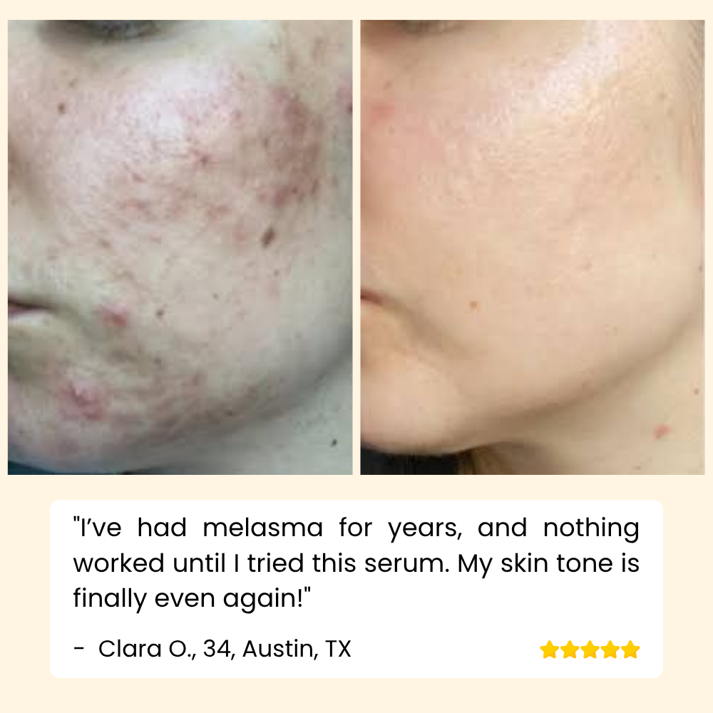 Vitamin C Serum für Hautpflege Gesicht und Körper product image 7