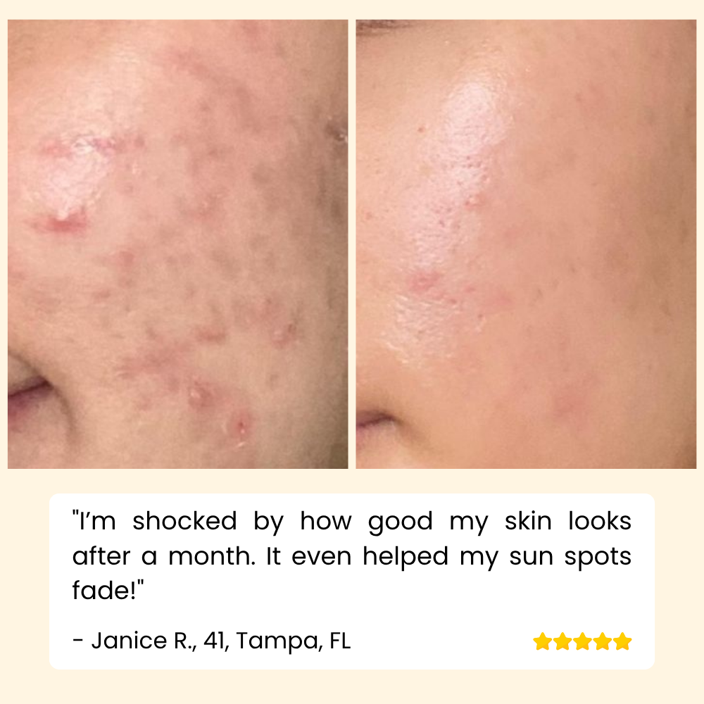 Vitamin C Serum für Hautpflege Gesicht und Körper product image 6