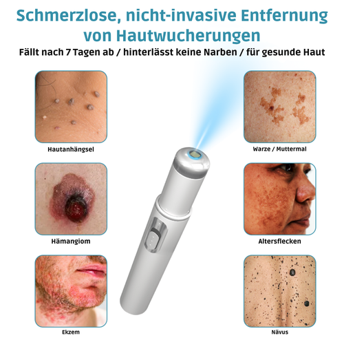 Hautpflege Gerät Für Kosmetische Anwendung Zuhause product image 2