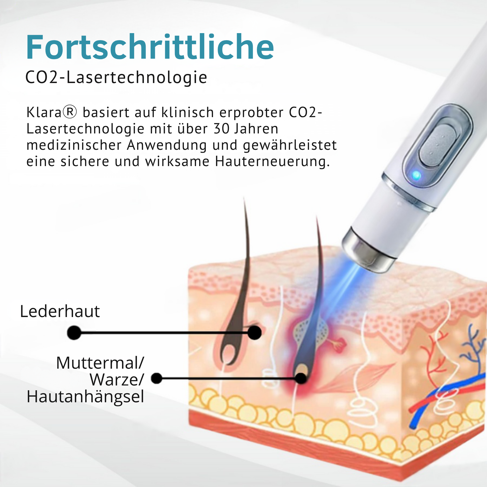Hautpflege Gerät Für Kosmetische Anwendung Zuhause product image 8