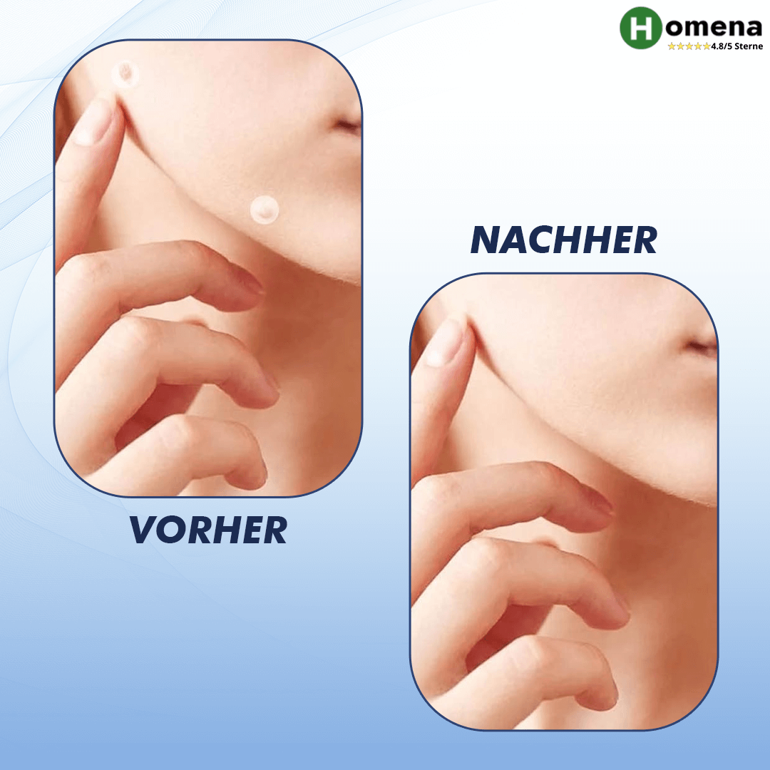 Hautpflege Patch Set Für Äußerliche Anwendung Hautbereich product image 4