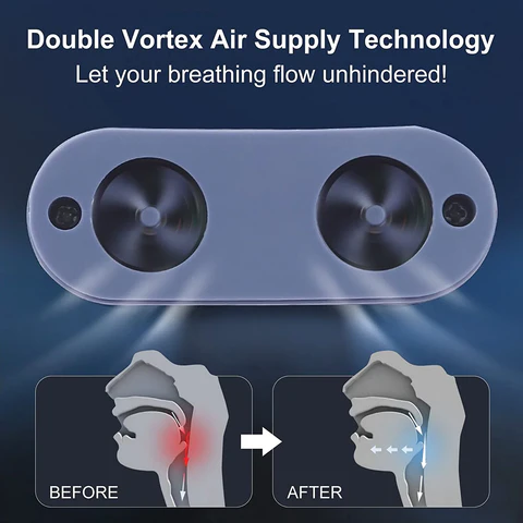 Nasal snoring stopper device - mask-free and USB-rechargeable