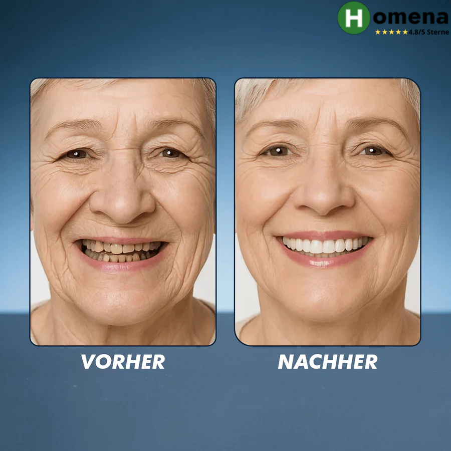 Vorher-Nachher Vergleich zeigt Wirkung der anpassbaren Zahnprothese für kosmetische Anwendung
