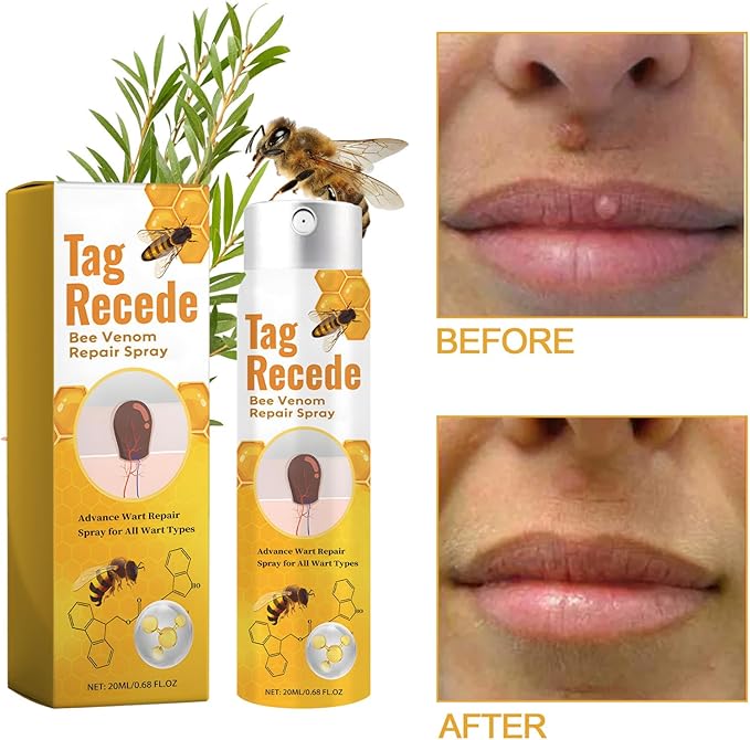 Hautpflege Flüssigkeit Für Hautstellen Äußerliche Anwendung product image 2